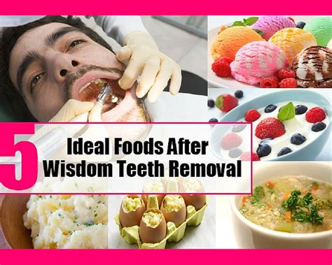 When Can I Eat Food After Tooth Extraction: A Journey Through Time and Taste Buds